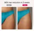Ulike Air 10 Pink 96% hair reduction in 2 weeks
